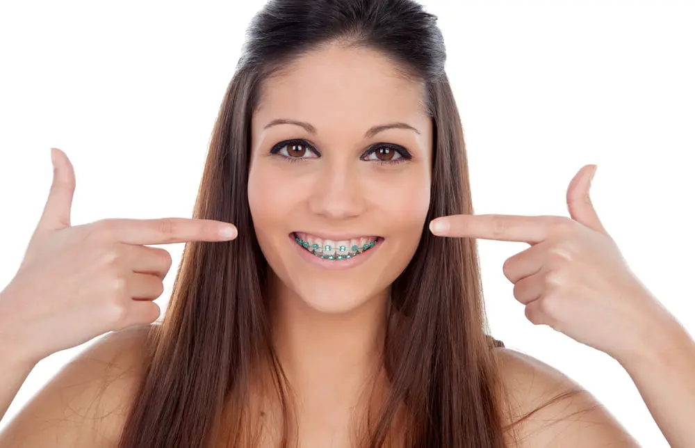 A young woman with long brown hair, wearing braces and smiling, points at her braces with both hands.