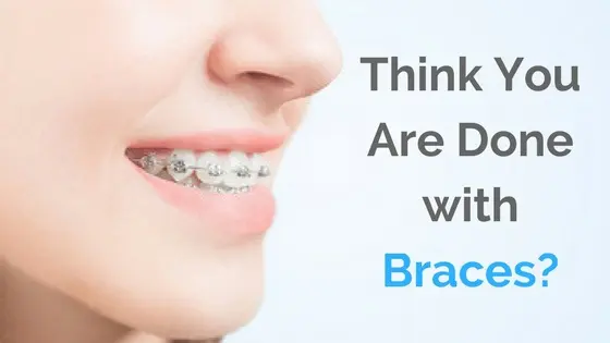 Braces Coming Off