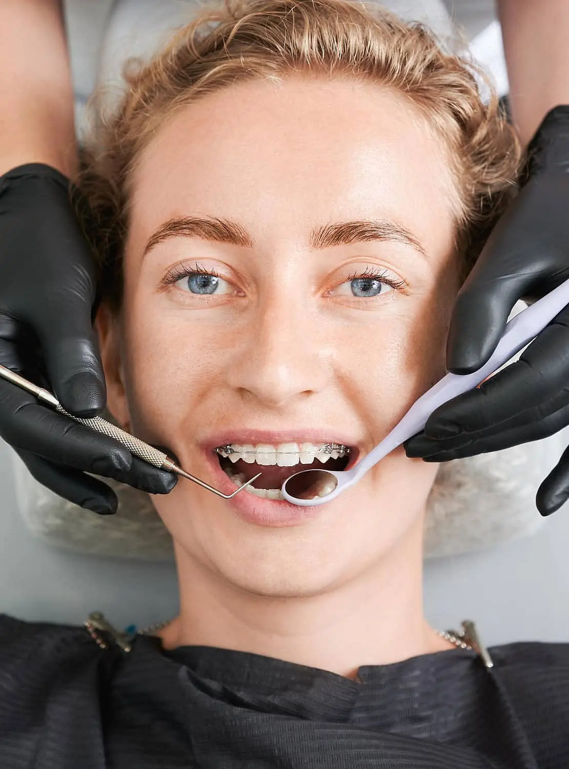 A person with clear braces is receiving a dental check-up. Dental tools, including a mirror and probe, are visible as the dentist in black gloves conducts the examination in Hamilton, OH