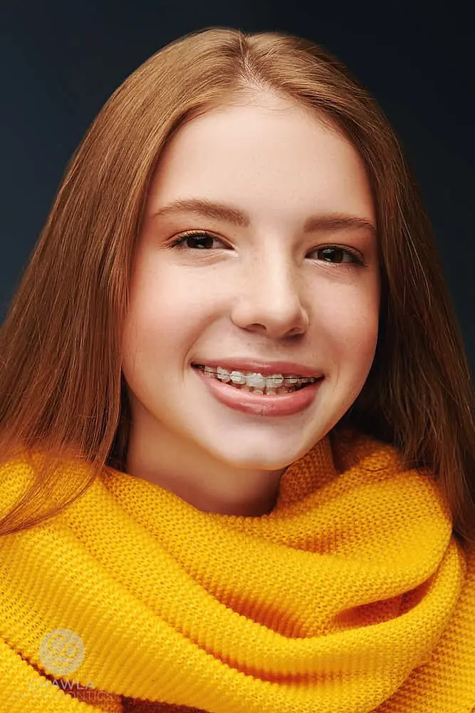 Teen girl with long hair smiles, showcasing her clear braces, and wears a vibrant yellow scarf against a dark background in Hamilton, OH