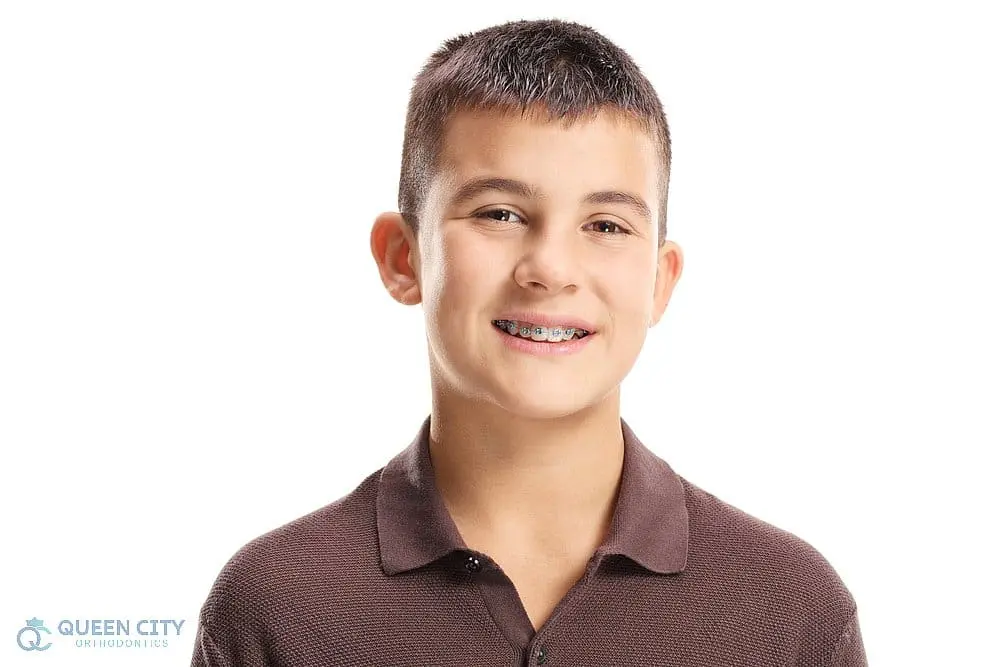 A boy with short dark hair and a brown polo shirt smiles, displaying metal braces on his teeth against a plain white background. The Queen City Orthodontics logo appears in the lower left corner, representing braces for overbite in Hamilton and Liberty Township, OH.