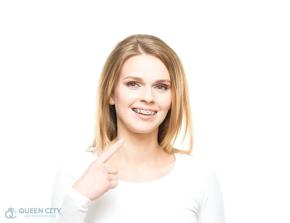 A woman with straight blond hair smiles and points to her metal braces against a white background, with the Queen City Orthodontics logo in the lower left corner—perfect for showcasing braces for overbite in Hamilton and Liberty Township, OH.