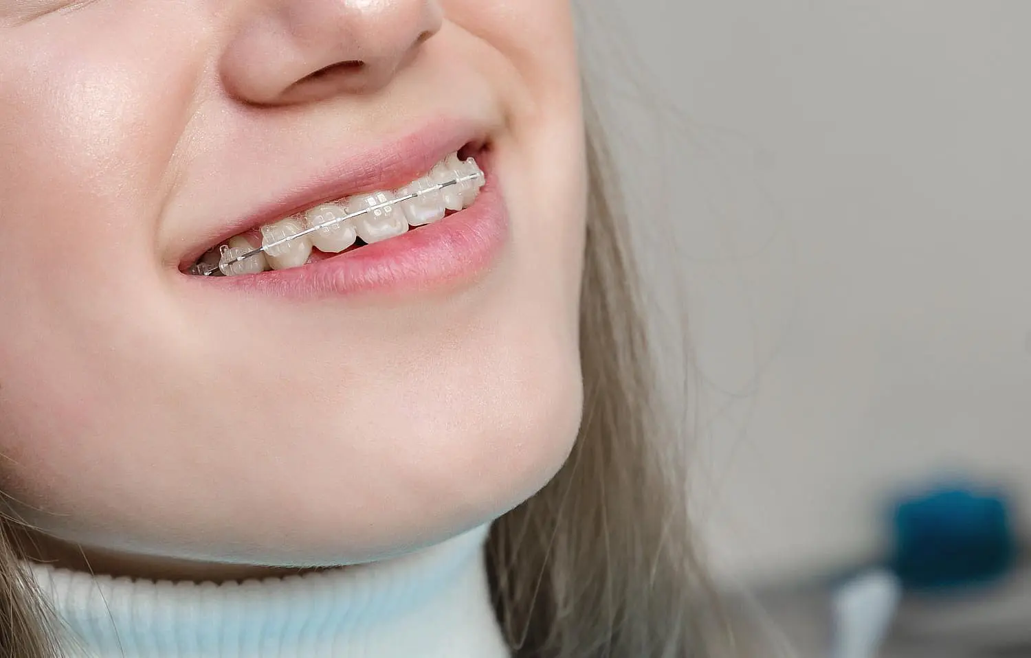 Smiling person with clear or ceramic braces, treated by Queen City Orthodontics in Liberty Township or Hamilton, OH.