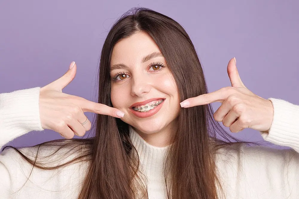 Smiling young woman with long brown hair points to metal braces, representing Queen City Orthodontics in Liberty Township or Hamilton, OH- How to Get Braces Glue Off Teeth in Liberty Township and Hamilton, OH