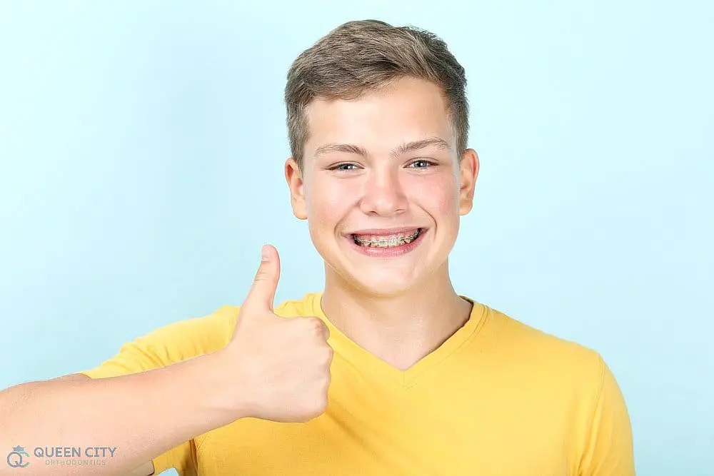 A teen boy with braces in a yellow shirt gives a thumbs-up for Queen City Orthodontics in Liberty Township or Hamilton, OH - How to Get Braces Glue Off Teeth in Liberty Township and Hamilton, OH